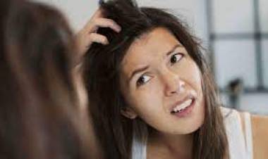 कोंड्यापासून मिळू शकते कायमची सुटका